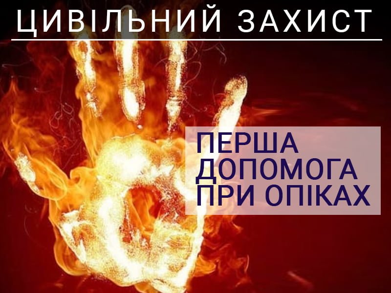 Перша допомога при опіках